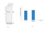 CHK2 Antibody in Western Blot (WB)