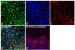 CHK2 Antibody in Immunocytochemistry (ICC/IF)