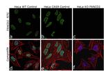 FANCD2 Antibody