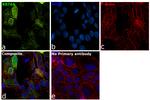 Cytokeratin 6 Antibody in Immunocytochemistry (ICC/IF)