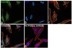 STAT5 alpha/beta Antibody in Immunocytochemistry (ICC/IF)