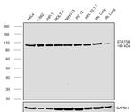 STAT5 alpha/beta Antibody in Western Blot (WB)