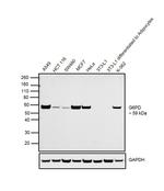 G6PD Antibody in Western Blot (WB)