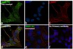 TRAIL-R2 (DR5) Antibody in Immunocytochemistry (ICC/IF)