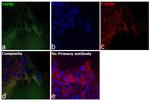 TGFBI Antibody in Immunocytochemistry (ICC/IF)