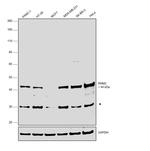 RRM2 Antibody in Western Blot (WB)