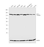 KIF11 Antibody in Western Blot (WB)