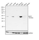 TdT Antibody