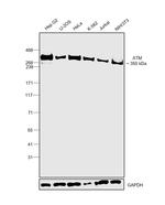 ATM Antibody in Western Blot (WB)