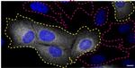 CHMP2B Antibody in Immunocytochemistry (ICC/IF)