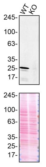 CHMP2B Antibody