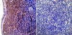 ICAM-1 Antibody in Immunohistochemistry (Paraffin) (IHC (P))