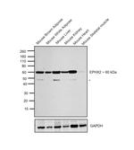 EPHX2 Antibody in Western Blot (WB)