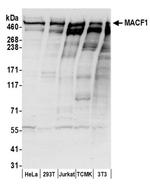 MACF1 Antibody in Western Blot (WB)