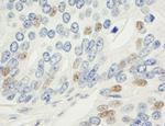 MAD1 Antibody in Immunohistochemistry (IHC)