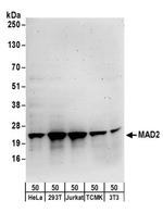 MAD2 Antibody in Western Blot (WB)