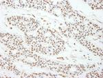 MAD2 Antibody in Immunohistochemistry (IHC)