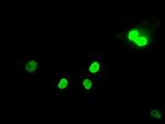 MAD2L1 Antibody in Immunocytochemistry (ICC/IF)