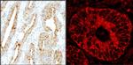 MADD Antibody in Immunohistochemistry (IHC)