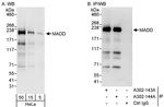 MADD Antibody in Western Blot (WB)