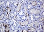 MAGEA3 Antibody in Immunohistochemistry (Paraffin) (IHC (P))