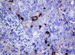 MAGEA3 Antibody in Immunohistochemistry (Paraffin) (IHC (P))