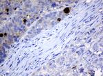 MAGEA3 Antibody in Immunohistochemistry (Paraffin) (IHC (P))