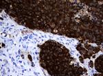 MAGEA3 Antibody in Immunohistochemistry (Paraffin) (IHC (P))