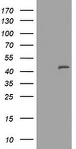 MAGEA3 Antibody in Western Blot (WB)