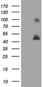 MAGEA3 Antibody in Western Blot (WB)