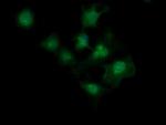 MAGEA4 Antibody in Immunocytochemistry (ICC/IF)