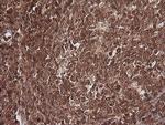 MAGEA4 Antibody in Immunohistochemistry (Paraffin) (IHC (P))