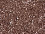 MAGEA4 Antibody in Immunohistochemistry (Paraffin) (IHC (P))