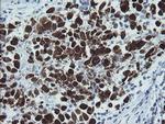 MAGEA4 Antibody in Immunohistochemistry (Paraffin) (IHC (P))