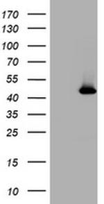 MAGEA4 Antibody in Western Blot (WB)