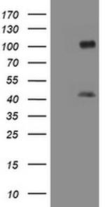 MAGEA9 Antibody in Western Blot (WB)