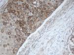 MAGEB1 Antibody in Immunohistochemistry (Paraffin) (IHC (P))