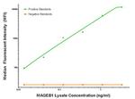 MAGEB1 Antibody in Luminex (LUM)