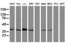 MAGEB1 Antibody in Western Blot (WB)