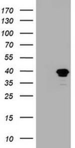 MAGEB1 Antibody in Western Blot (WB)