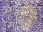 MAGEB18 Antibody in Immunohistochemistry (Paraffin) (IHC (P))