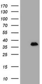 MAGEB18 Antibody in Western Blot (WB)