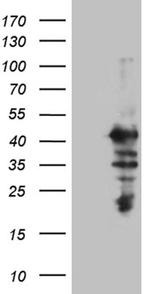 MAGEB2 Antibody in Western Blot (WB)