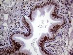 MAGEB4 Antibody in Immunohistochemistry (Paraffin) (IHC (P))