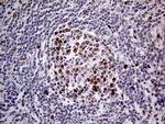 MAGEB4 Antibody in Immunohistochemistry (Paraffin) (IHC (P))