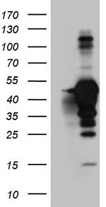 MAGEB4 Antibody in Western Blot (WB)