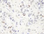 MAGED2 Antibody in Immunohistochemistry (IHC)