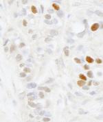 MAGED2 Antibody in Immunohistochemistry (IHC)