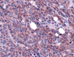 MALT1 Antibody in Immunohistochemistry (IHC)