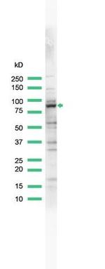 MALT1 Antibody in Western Blot (WB)